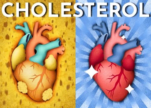 Keto and Cholesterol Thumbnail