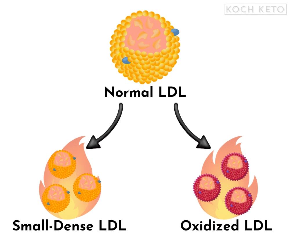 sdLDL and oxLDL Infographic