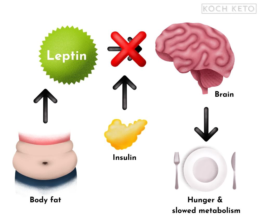 Too Much Insulin May Cause Leptin Resistance Infographic